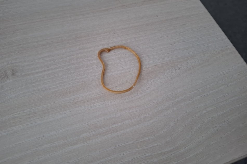 Prešovčanka našla v žemľovke gumičku