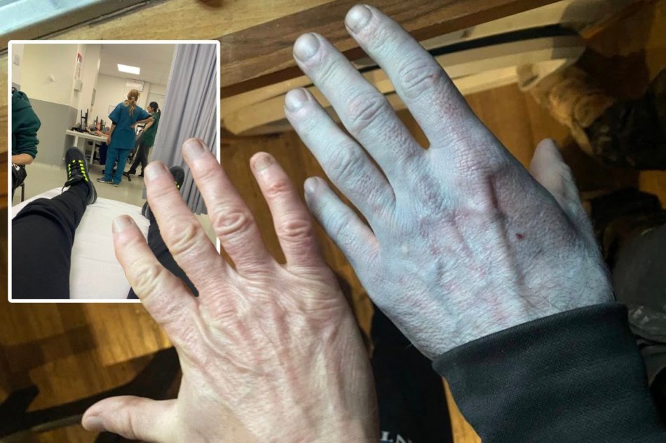 Muž sa zobudil a jeho telo bolo celé modré